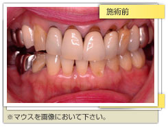 審美治療施術前