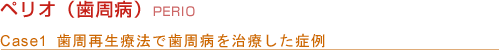 ペリオ（歯周病）PERIO Case1 歯周再生療法で歯周病を治療した症例